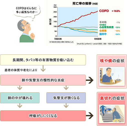 40才以上の日本人の500～600万人がこの病気にかかっている